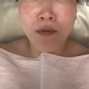 엘로우케어 | 로즈마리 에스테틱 웨딩케어 윤곽관리 쌍문역피부관리 스킨케어추천 굿굿~