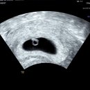 거북섬한방병원 | 6주~9주차#👶🏻임신기록,입덧, 입덧약,젤리곰,난임병원 졸업