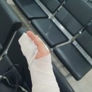 오훈정형외과 네이버블로그