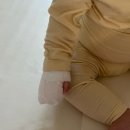 새솔약국 | 아기 손가락 표재성 2도 화상 치료/ 화상 응급처치 방법 / 수원 새솔 외과 의원