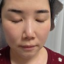 이노트 | 맑은결 토너 세럼 크림 추천 환절기 피부결 피지 고민에 이노트 메디섹션넘버M 후기