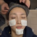 필아쿠아 | 청담동 여드름 피부과 추천 아큐토닝, 아쿠아필 부작용, 효과 후기