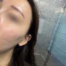 태평양프라자 | 상동여드름관리 뷰티포톤피아 슈렉필 재방문 후기