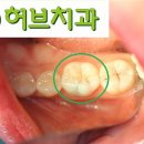 구리허브치과 티스토리