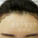 헤어라인 이미지