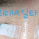 아무네일 속눈썹 이미지