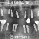 미켈란치과의원 네이버블로그