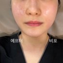 동구 두 번째 학교 | 대구동구 윤곽피부관리 끌라르떼에스테틱 알테온 인생 윤곽 찾았어요