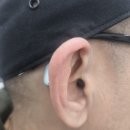 군산유니트론보청기 이미지