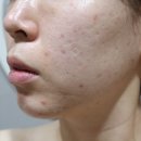 벤자롱스파삼성노블카운티점