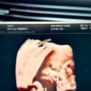 광교은산부인과의원 이미지