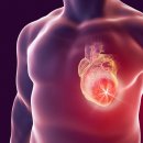 Muscle Attack 이미지