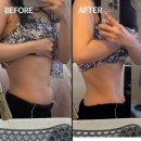 중동역 | 해운대 복부 슬리밍 후기 │ 중동역 에끌라브띠끄 4in1 테라피 전후 변화