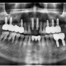 이건치과기공소 이미지