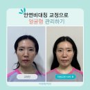 (주)리샘 | 예쁜 얼굴형+얼굴윤곽 관리