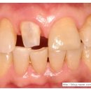 세라믹치과기공소 이미지