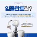 홍천치과의원 네이버블로그
