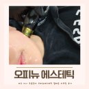 다사 | 대구 다사 주름관리 오피뉴에스테틱 알테온 리프팅 후기