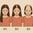 연세모벨르의원 종로본점_내돈내산 후기