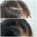 새로이숲부평 | 인천 두피문신 SMP 잘하는 곳 찾는 방법 대공개!