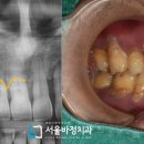 서울바정치과의원 이미지