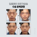 플레인의원