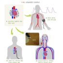 5대 심장질환 분류표와 2대 심장질환 분류표의 비교 이미지