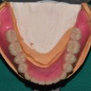 바라던 치과기공소 이미지