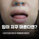 입이 자꾸 마른다면? 구강건조증 원인과 해결 방법 총정리 | 안양치과