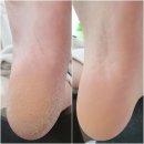 로제네일 이미지