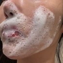 얼굴 오돌토돌 피부 닭살 없앤 후기