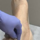 리포윅스슈가링왁싱수원 | 압구정왁싱 [리포윅스 압구정]자극 없이 매끈한 종아리 슈가링 왁싱 솔직 후기