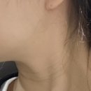 엠제이피부과의원 | [피부관리] 브이엠제이 피부과 울쎄라 (3주차 후기)