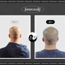 조선스칼프 이미지