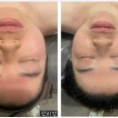 [광양읍 마사지] &#39;황실피부관리실&#39;, 얼굴관리 후기(내돈내산)