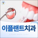 이플랜트치과의원