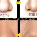 조각성형외과의원 이미지