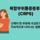 이영약품 | 인간이 느끼는 가장 무서운 고통 복합부위통증증후군