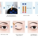 가인비뇨기과 이미지