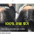 밀스칼프