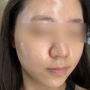 스킨클래스 | 부천 신중동 피부관리 미모클래스 물광 스킨플래닝 후기