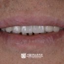 덕치과기공소 이미지