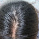 비알비헬스케어(여 | 여성전용 탈모샴푸 이너시아 샴푸 솔직후기