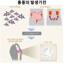 모현큰약국 | 옵티마[질병: 통풍] 후기