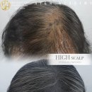 오직 스칼프 이미지