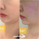 본아에스테틱 | 운정 피부관리 본아에스테틱 / 윤곽 수기 60분 후기 (야당 피부관리 추천)