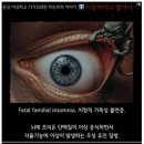 죽을 때까지 잠 못자는 병 이미지