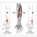 Flexor Carpi Radialis (요측 수근굴근) 이미지