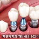 차앤박치과의원 | 수원임플란트치과 긴장이 풀렸어요.