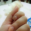 Nail U